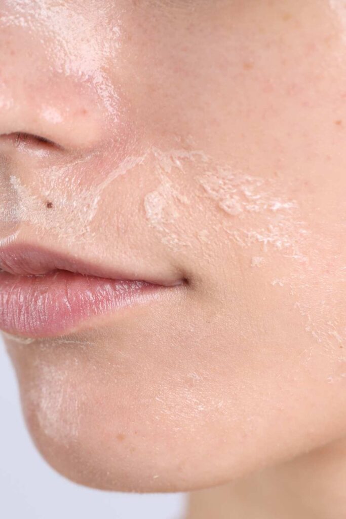 A lady with dry face